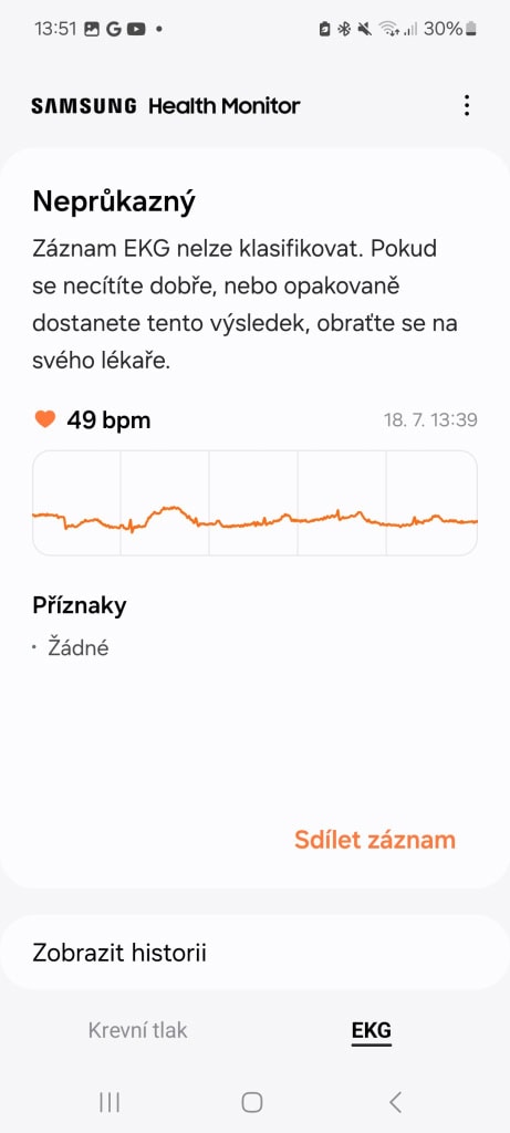 Záznam měření EKG